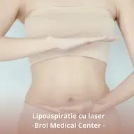 Abdomen plat și fără grăsime prin lipoaspirație cu laser