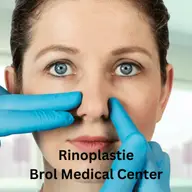 Rinoplastia: operatia care iti schimba intrega fizionomie a fetei