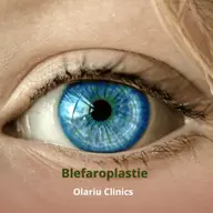 Blefaroplastie la Olariu Clinics