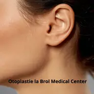 Otoplastia: transformarea aspectului și reconstrucția increderii în sine