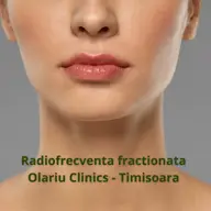 O piele mai ferma si fara riduri cu radiofrecventa fractionata