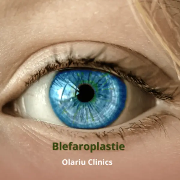 Blefaroplastie la Olariu Clinics